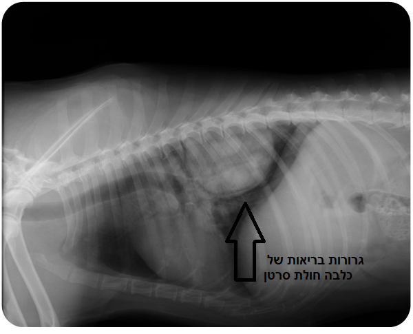 x-ray chest mass